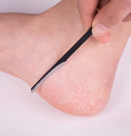 Ścinak do pięt | pedicure